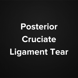 Posterior Cruciate Ligament Tear