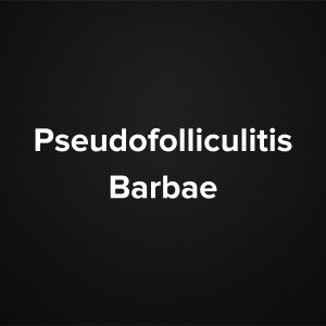 Pseudofolliculitis Barbae