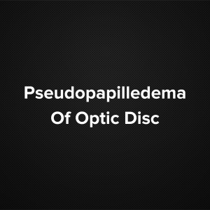 Pseudopapilledema of Optic Disc