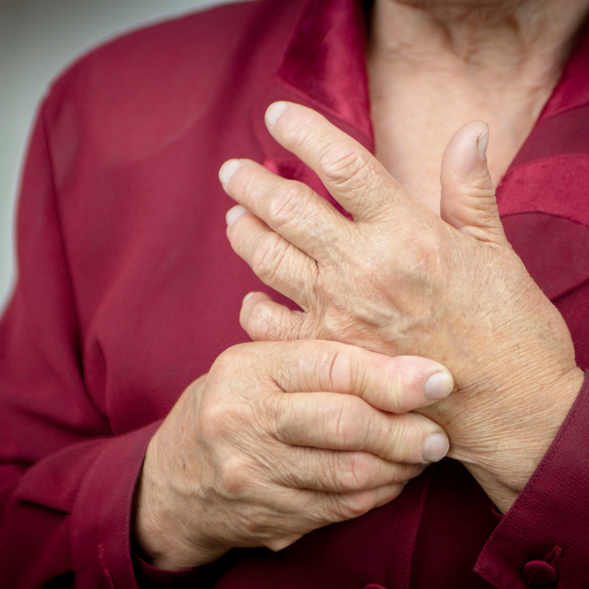 Rheumatoid Arthritis