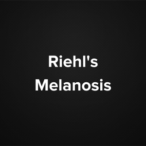 Riehl’s Melanosis