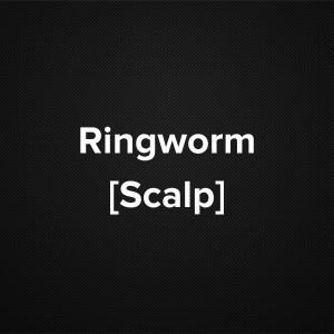 Ringworm [Scalp]