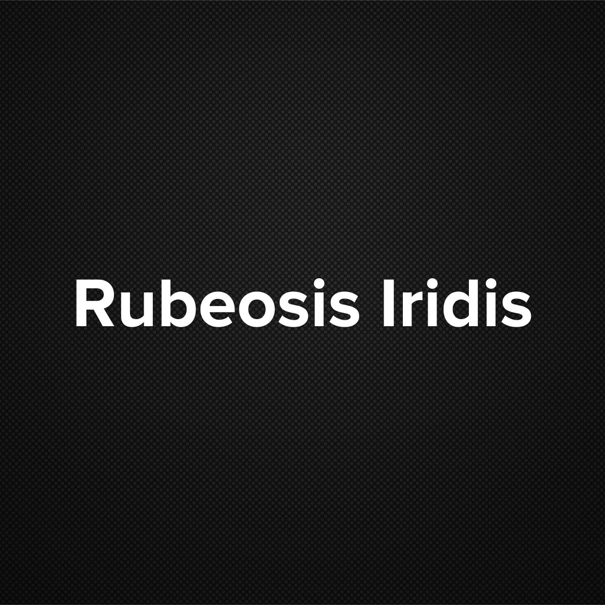 Rubeosis Iridis