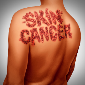 Skin Cancer