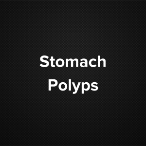 Stomach Polyp