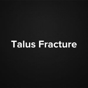 Talus Fracture