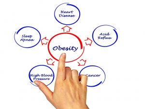 The causes of obesity