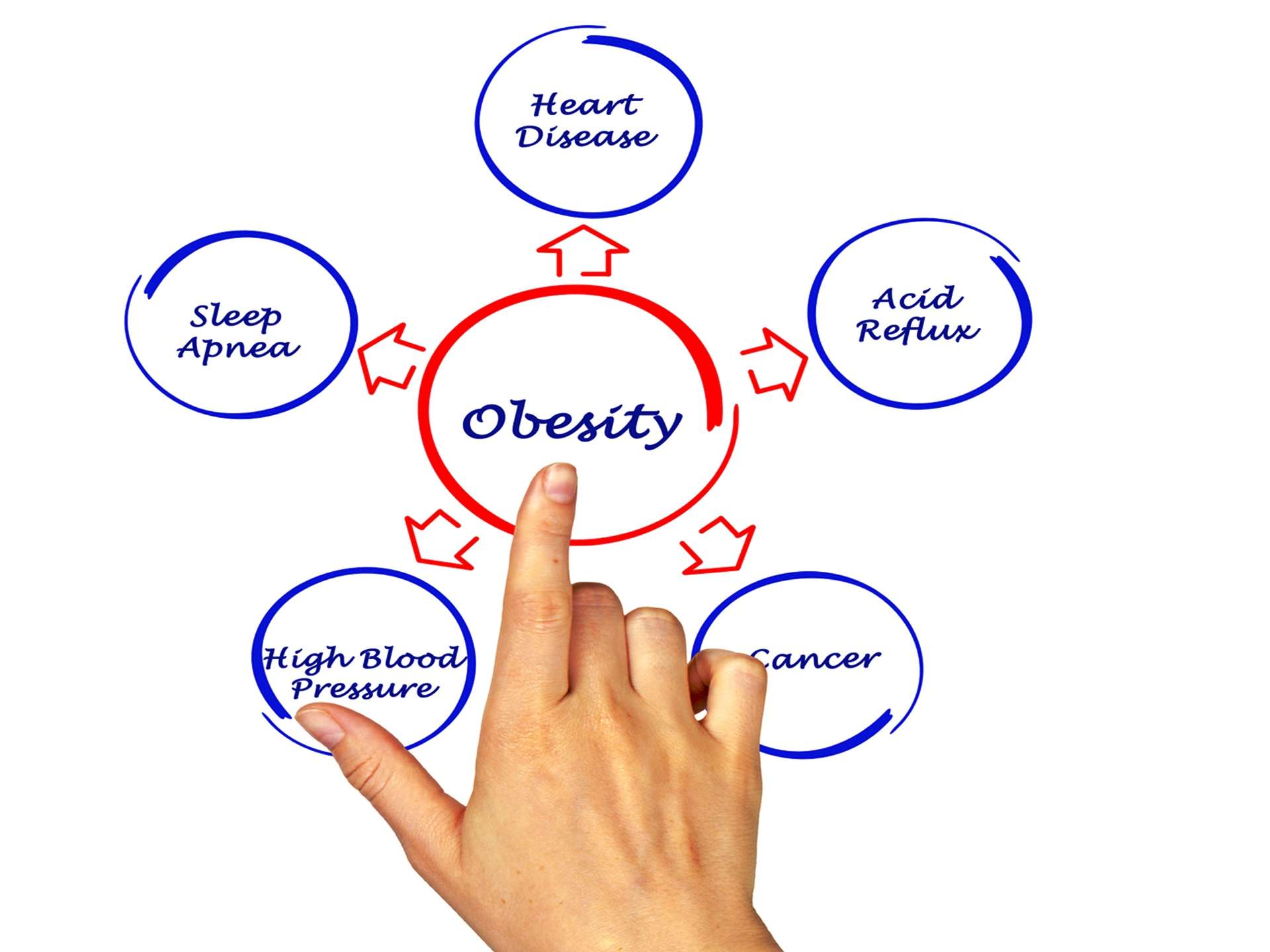 The causes of obesity