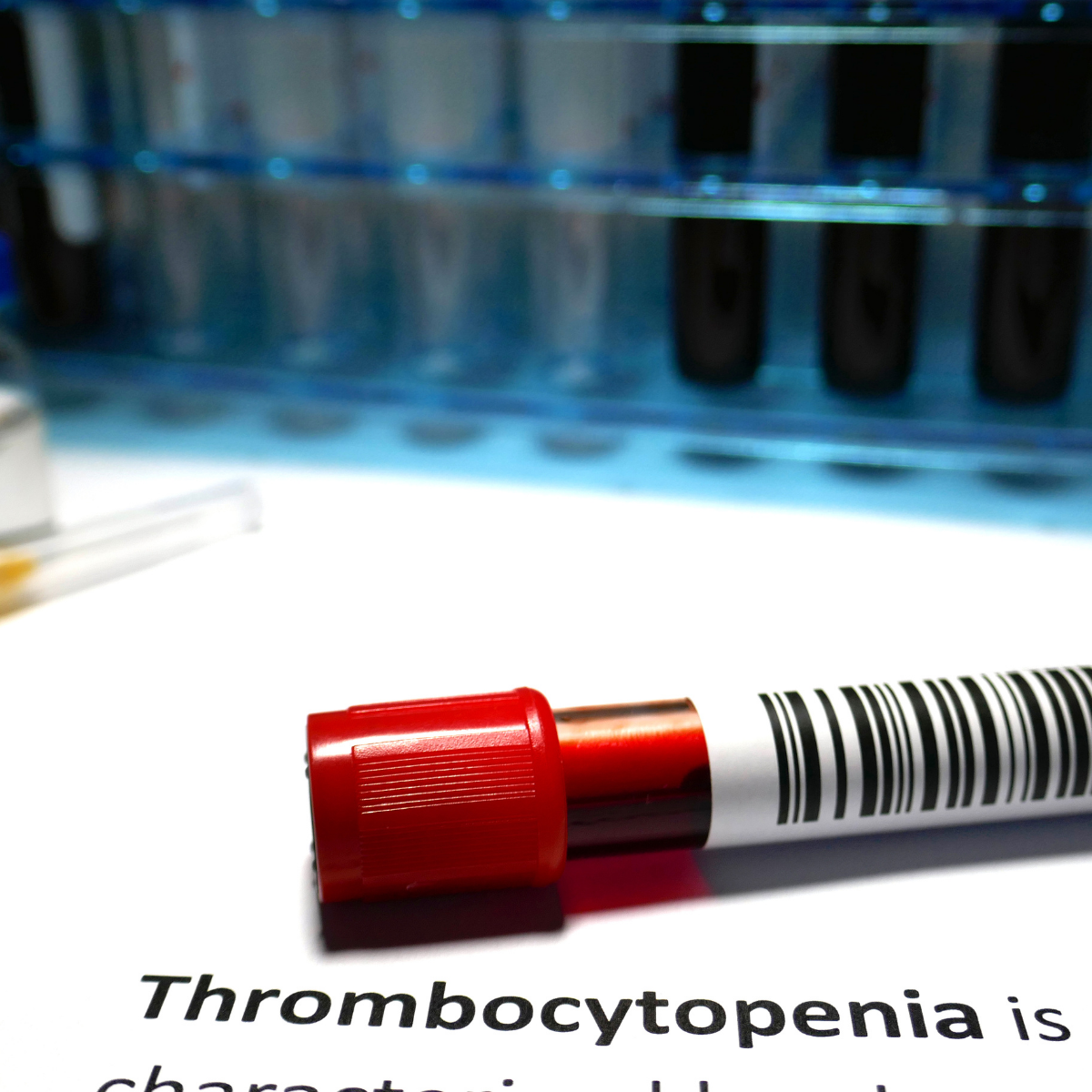 Thrombocytopenia