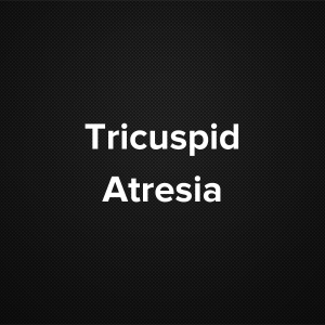 Tricuspid Atresia