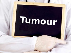 Tumor markers: The aide to mark cancer