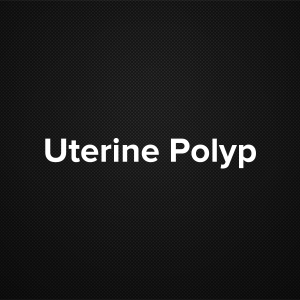 Uterine Polyp