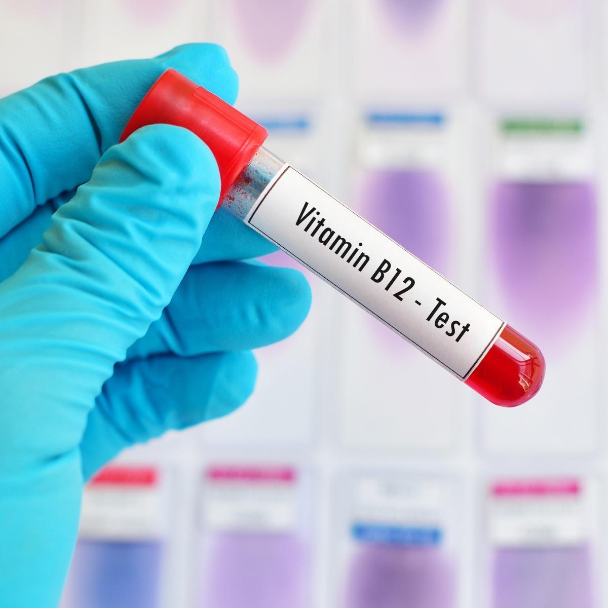 Vitamin B12 deficiency anemia