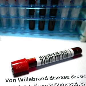 Von willebrand disease