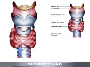 What causes hypothyroidism?