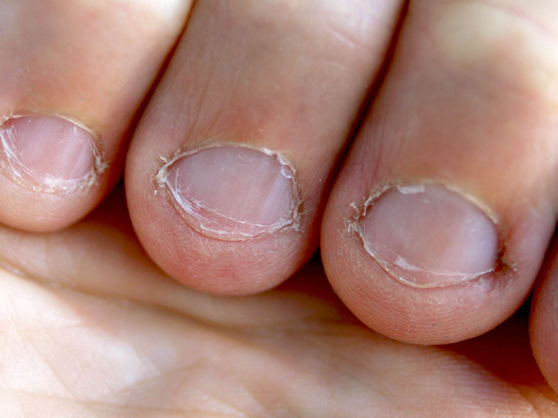 What your nails speak about your health