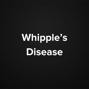 Whipple’s Disease