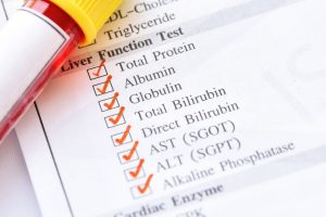 LIVER FUNCTION TEST (LFT)