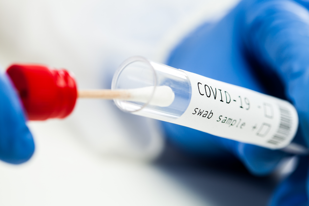 RT PCR TEST FOR COVID