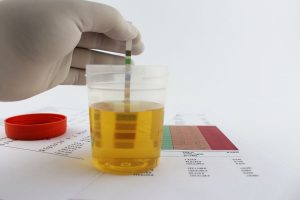 URINE ROUTINE