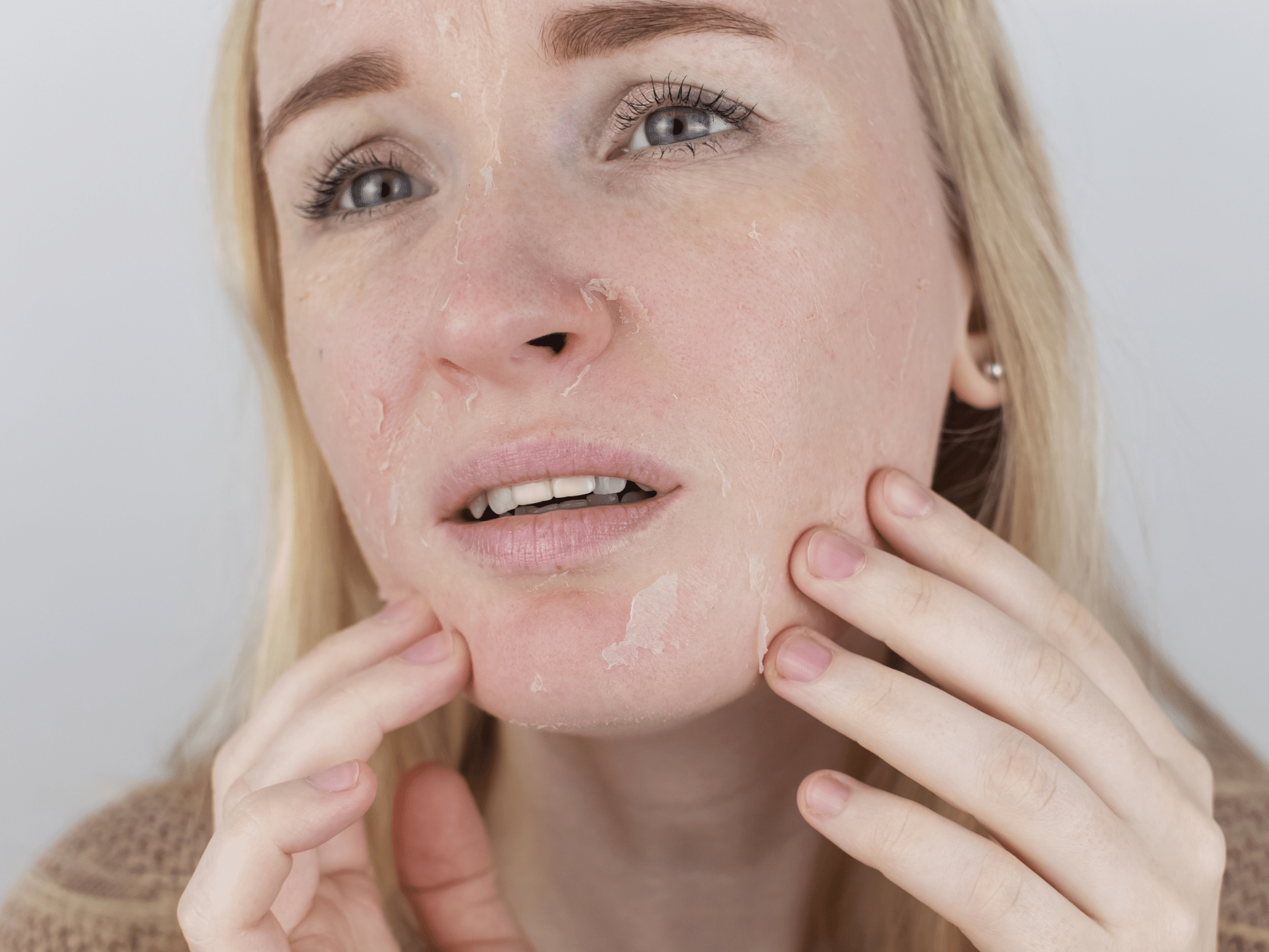 Breathing life into your dry skin